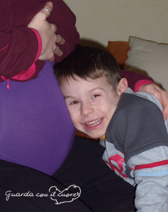 Guarda Con Il Cuore Sindrome Di Down Pesaro